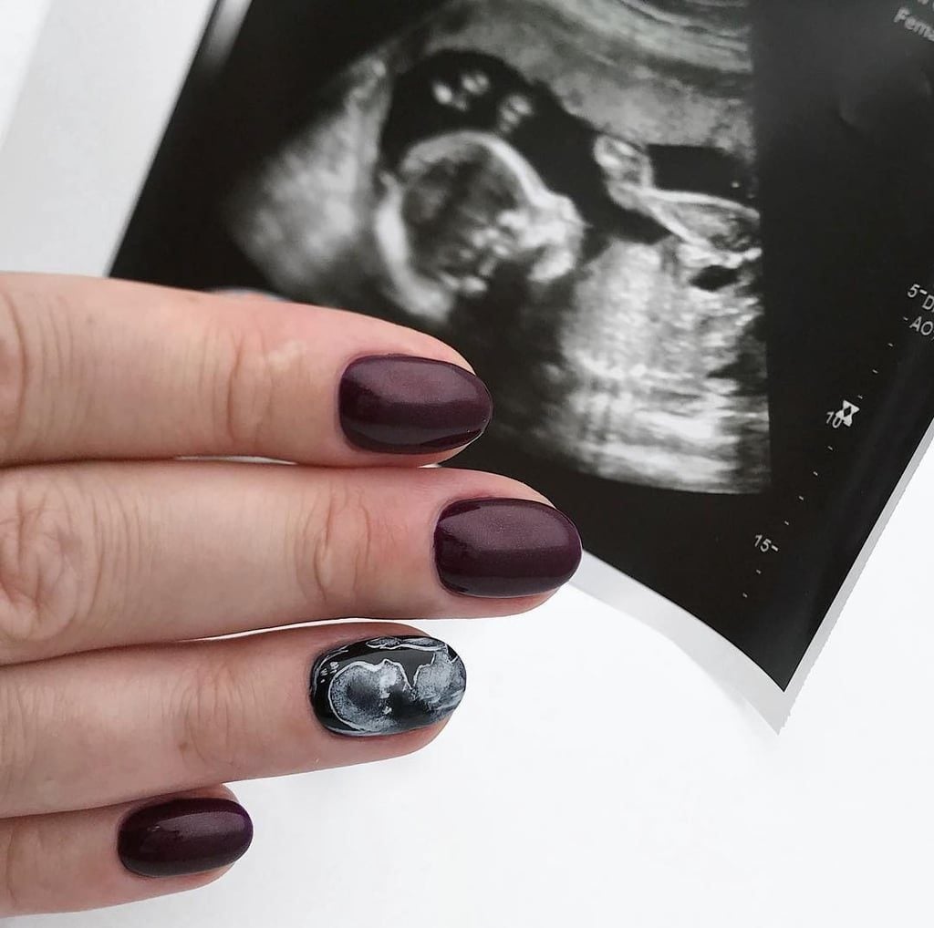 Ultrasound Nails Are Trending On The ‘Gram Now