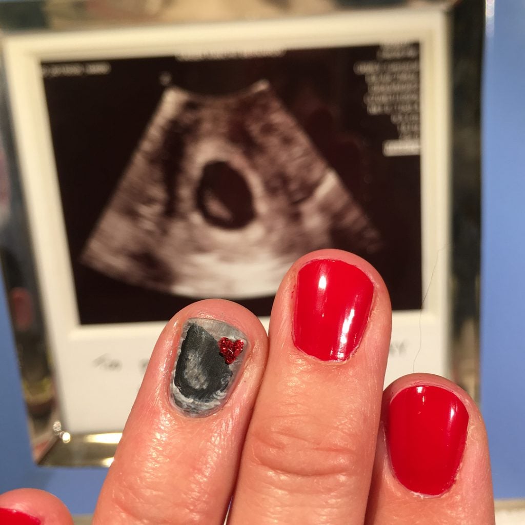 Ultrasound Nails Are Trending On The ‘Gram Now