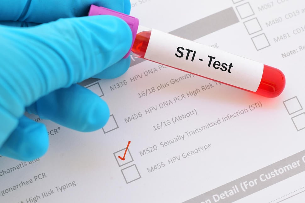 STI test | 8 Self-Checks Every Woman Should Do | Her Beauty