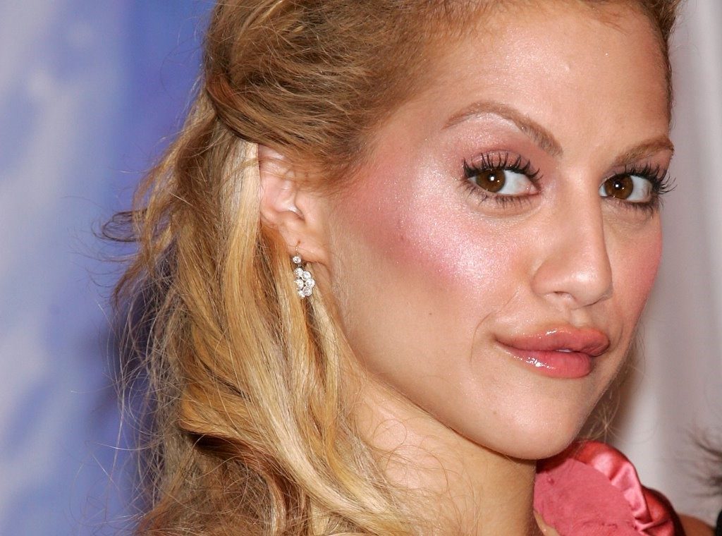7 Reasons NOT to get Botox