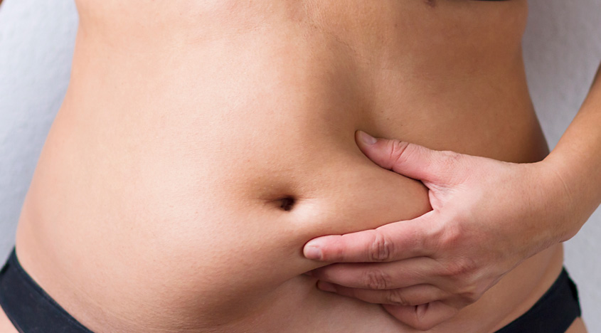 Everything To Know About The Non Surgical Tummy Tuck
