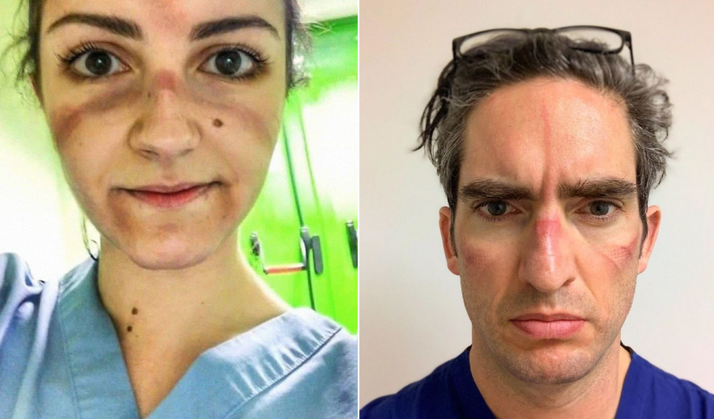 Shocking Photos of Exhausted COVID-19 Doctors