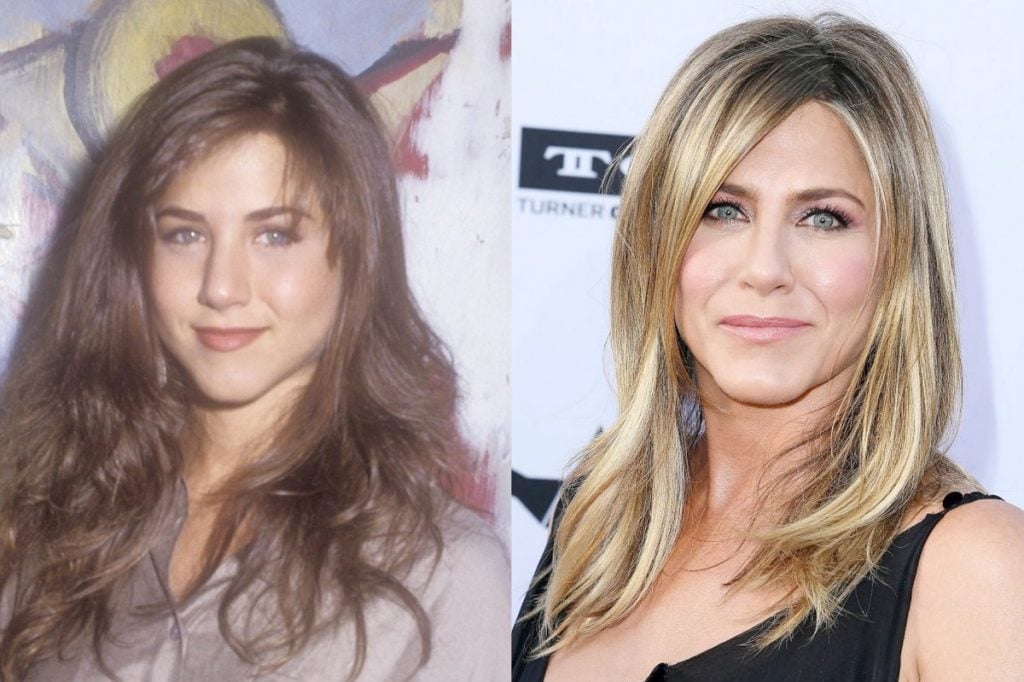 Most Stunning Plastic Surgery Transformations