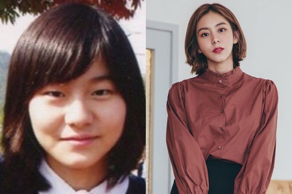 K-Pop and Plastic Surgery Go Hand In Hand