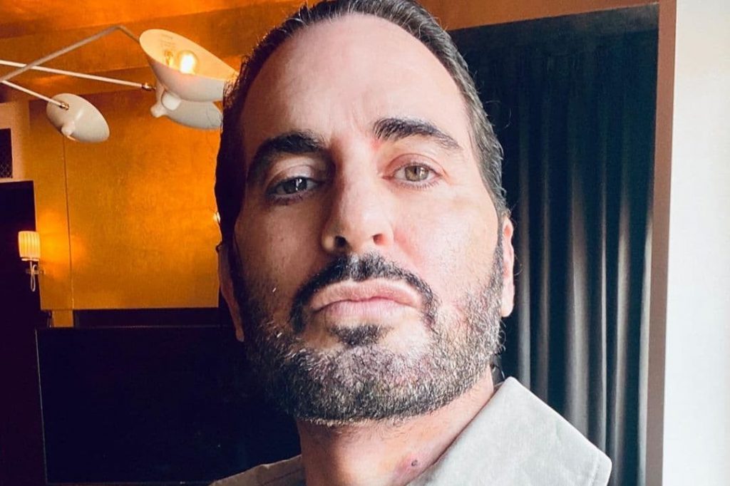Marc Jacobs Publicly Documenting His Plastic Surgery
