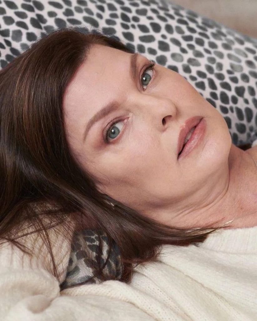 Linda Evangelista muestra su cuerpo tras la cirugía