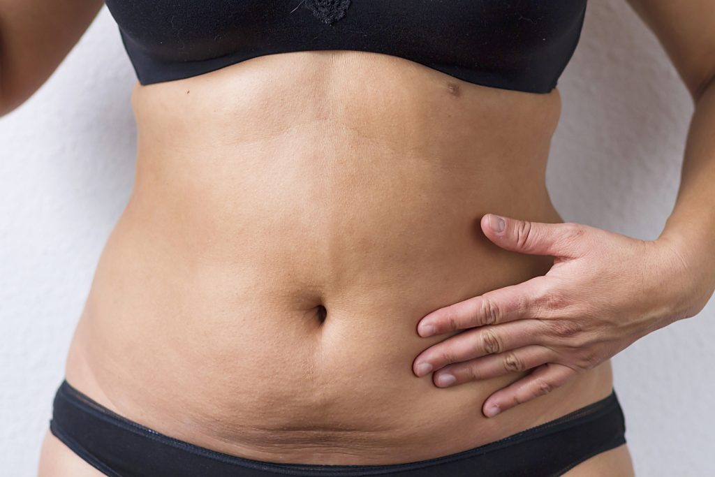 What Your Body Fat Type Says About Your Health
