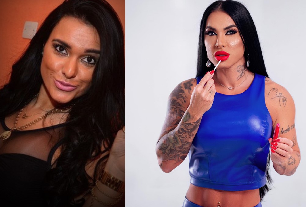 Harmonização facial: as mudanças dos participantes da Fazenda 15