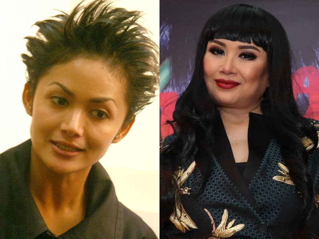 6 Artis Cantik Ini Ternyata Pernah Operasi Plastik!