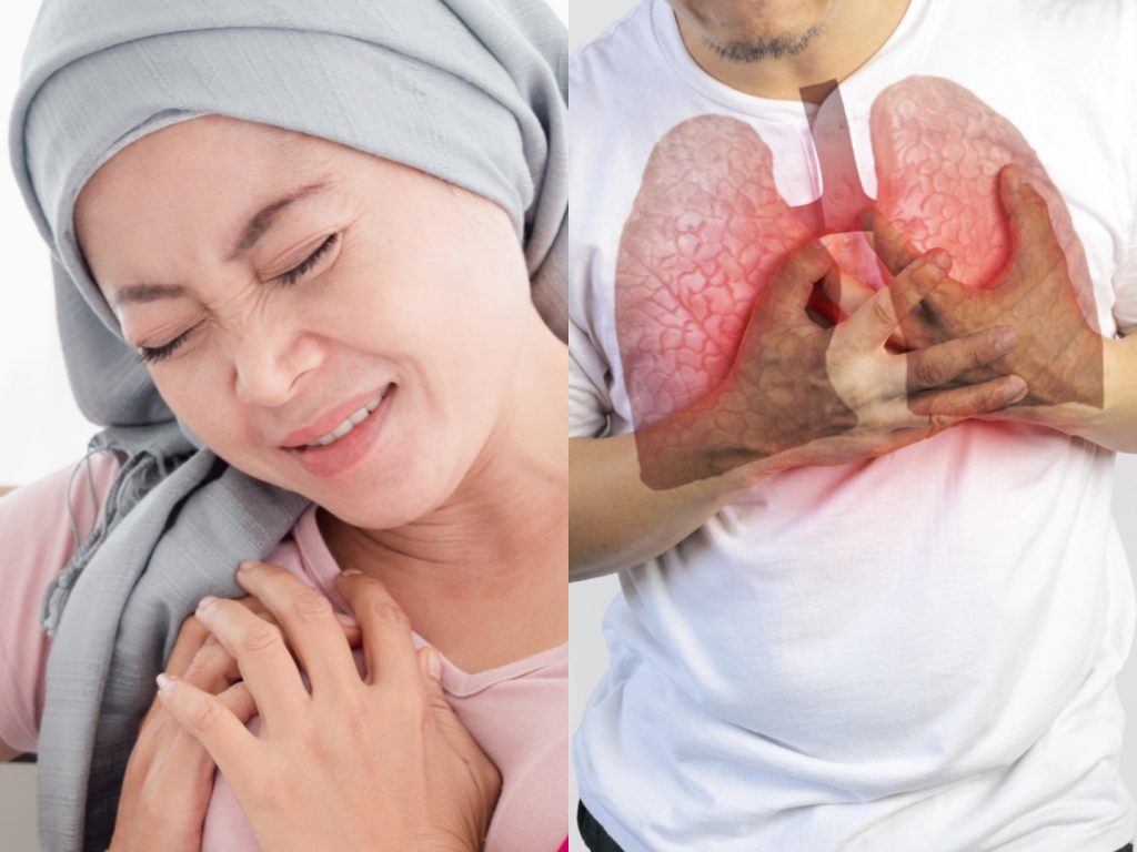 Nyeri Berkepanjangan di 6 Bagian Tubuh Ini Bisa Jadi Gejala Kanker!