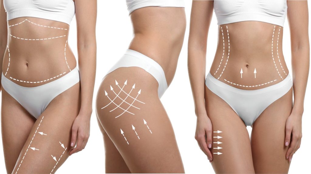 Pelle a buccia d’arancia: i rimedi più efficaci contro la cellulite