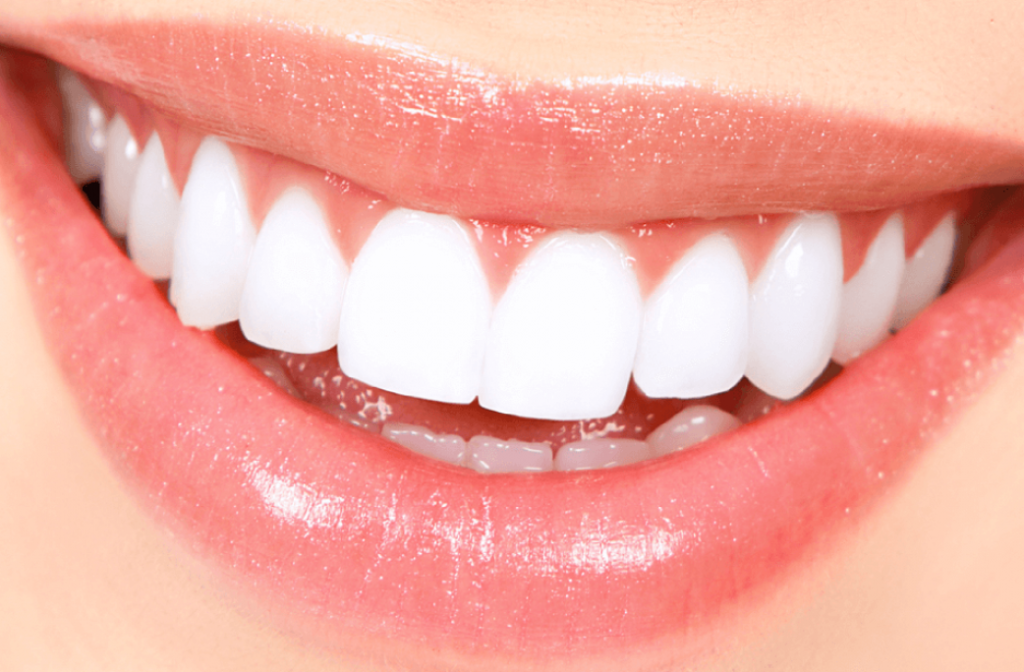 Il segreto delle star per avere denti bianchissimi 