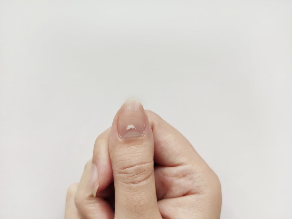O que a meia-lua da sua unha quer dizer (e como a unha pode revelar problemas de saúde)
