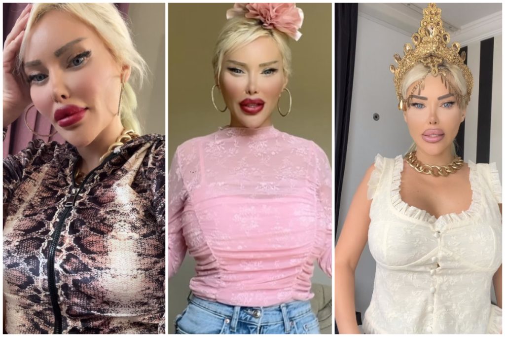 Türk Barbie Pınar Özkurteller Kimdir? Estetikle Gelen Şöhretin Hikayesi!