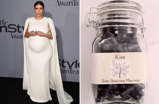 Kim Kardashian’ın Kameralar Karşısında Başına Gelen En Garip On Olay