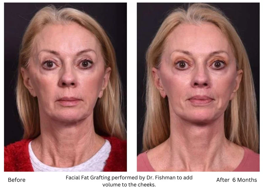 The Biggest Facial Plastic Surgery Trends—The Good, The Bad, and The “Wait, Why?”