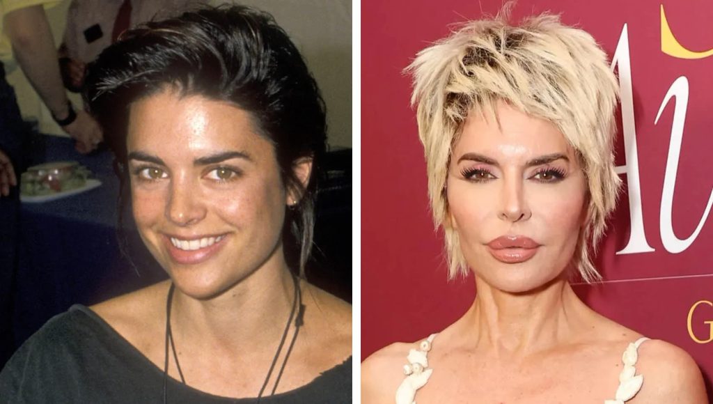Lisa Rinna’s Plastic Surgery Journey: The Most Honest Transformation Story in Hollywood