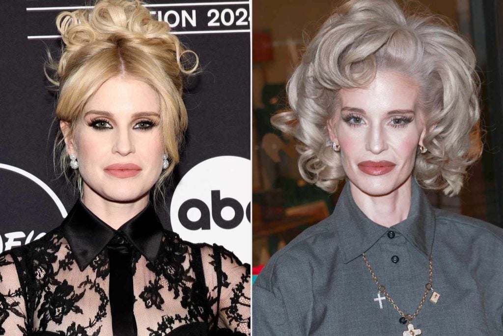 The Worst “Ozempic Face” Transformations in Hollywood