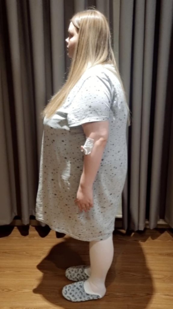 Neuvěřitelná proměna ze 150 kg na velikost S