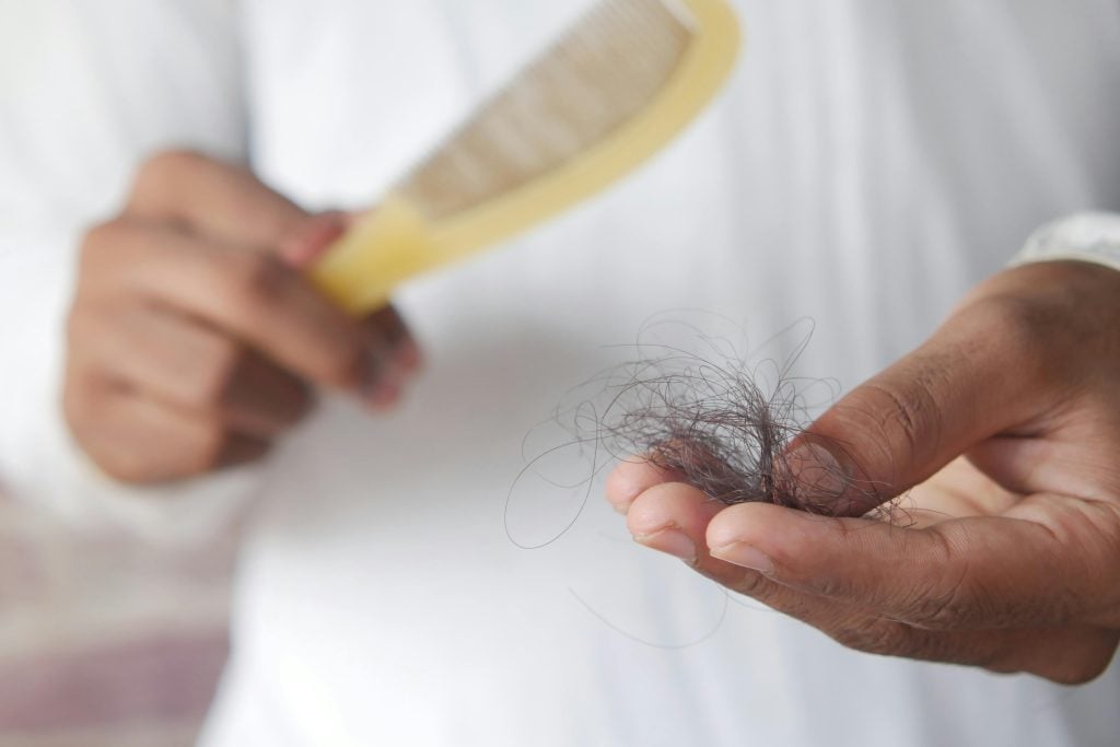 Gợi ý những biện pháp hiệu quả ngăn ngừa bệnh rụng tóc