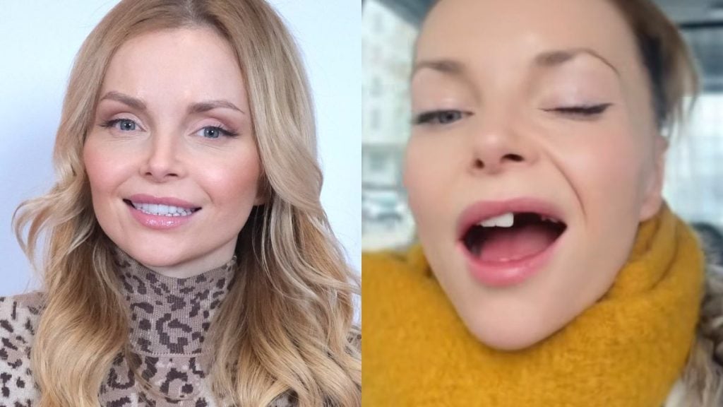 Izabella Miko: Od Hollywood do… wyjmowania zębów? Co tu się dzieje?!