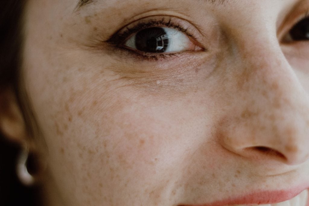 Cómo reducir las manchas de la edad y cuidar tu piel sin cometer errores